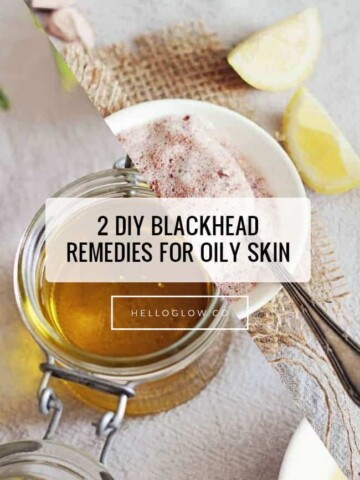 2 Blackhead Remedies for Oily Skin - 